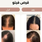 کپسول مکمل تقویت کننده مو و ناخن 120 عددی - تصویر 3