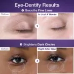 کرم دور چشم نامبوزین شماره ۹ حاوی NAD+ و رتینول 3