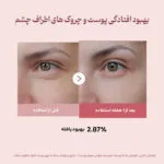 کرم دور چشم پی دی آر ان و پپتاید مدی کیوب 4